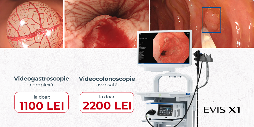 videogastroscopie-si-videocolonoscopie-avansata-diagnosticul-precoce-si-exact-al-afectiunilor-digestive-969f2393.png